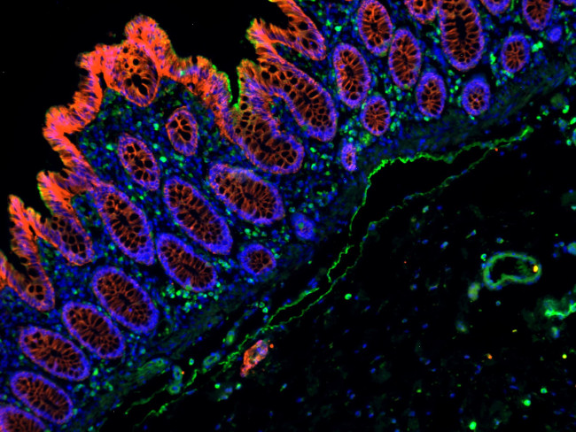 Mouse IgG (H+L) Cross-Adsorbed Secondary Antibody in Immunohistochemistry (Paraffin) (IHC (P))