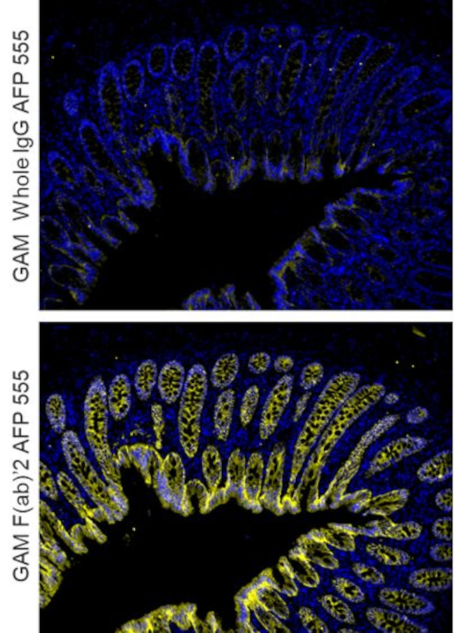 Mouse IgG (H+L) Cross-Adsorbed Secondary Antibody in Immunohistochemistry (Paraffin) (IHC (P))