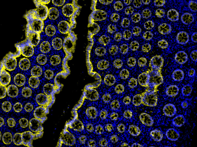 Mouse IgG (H+L) Cross-Adsorbed Secondary Antibody in Immunohistochemistry (Paraffin) (IHC (P))