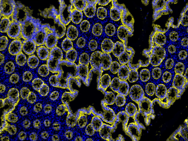 Mouse IgG (H+L) Cross-Adsorbed Secondary Antibody in Immunohistochemistry (Paraffin) (IHC (P))