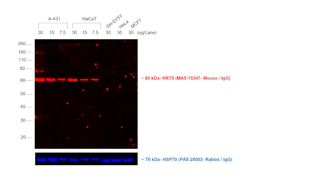 Mouse IgG (H+L) Cross-Adsorbed Secondary Antibody in Western Blot (WB)