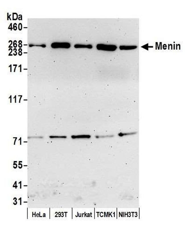 Menin Antibody in Western Blot (WB)