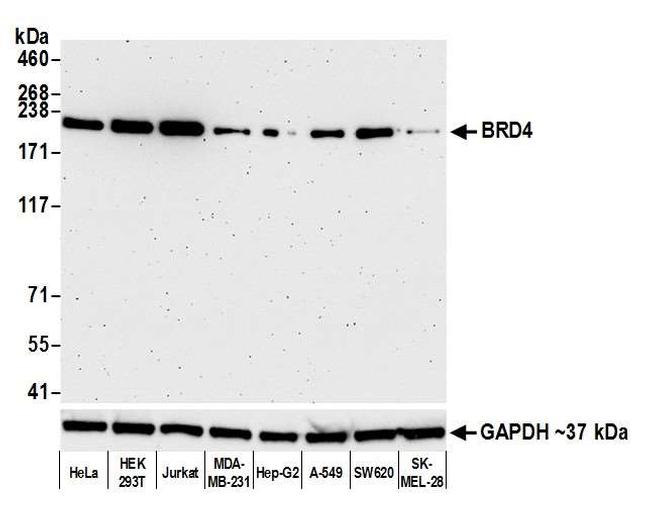 BRD4 Recombinant Monoclonal Antibody (BL-151-6F11) (A700-005)