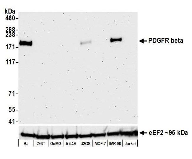 PDGFR Beta Recombinant Monoclonal Antibody (BLR081G) (A700-081)