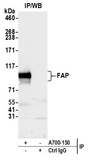 Fibroblast Activation Protein alpha/FAP Antibody in Immunoprecipitation (IP)