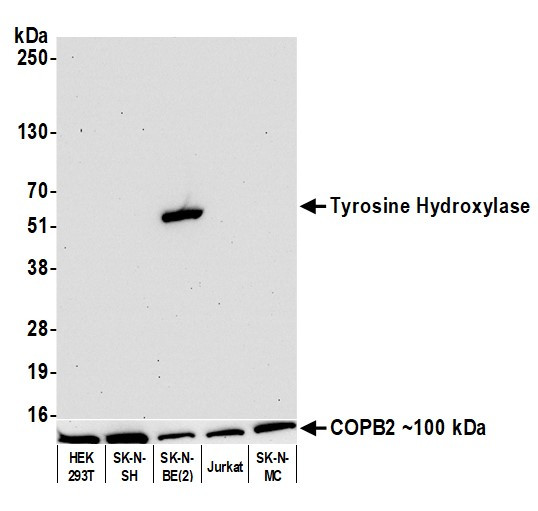 Tyrosine Hydroxylase Antibody in Western Blot (WB)