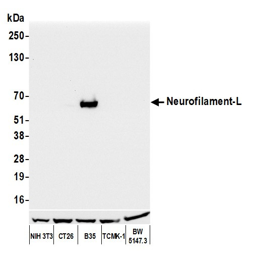 Neurofilament-L Antibody in Western Blot (WB)