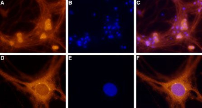 Adenosine A1 Receptor Antibody in Immunocytochemistry (ICC/IF)