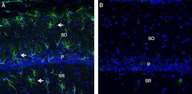 C5aR2 (extracellular) Antibody in Immunohistochemistry (Frozen) (IHC (F))