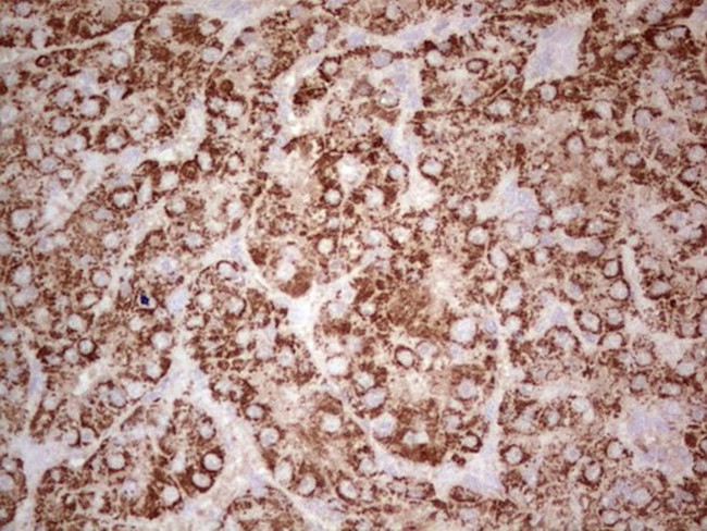 ABAT Antibody in Immunohistochemistry (Paraffin) (IHC (P))