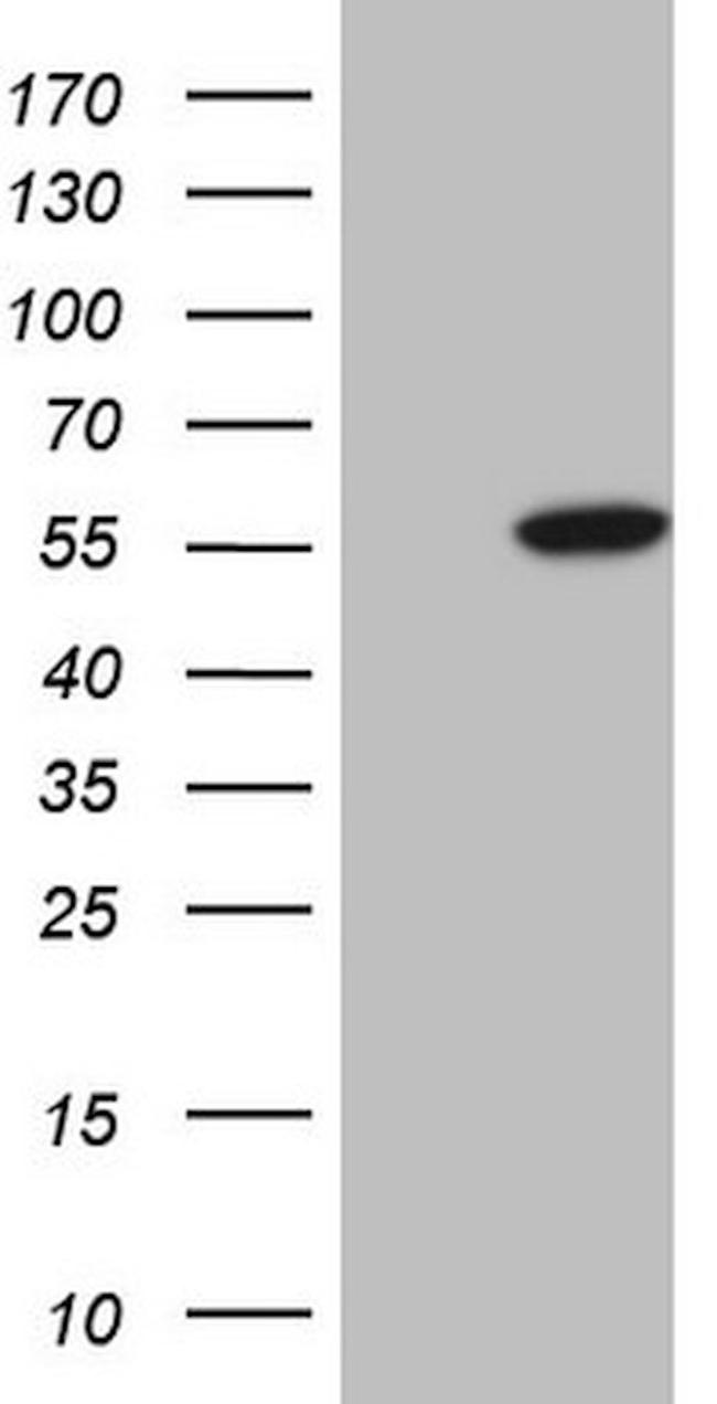 ABAT Antibody in Western Blot (WB)