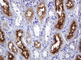 ABCB1 Antibody in Immunohistochemistry (Paraffin) (IHC (P))