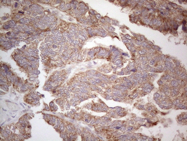 ABCC5 Antibody in Immunohistochemistry (Paraffin) (IHC (P))