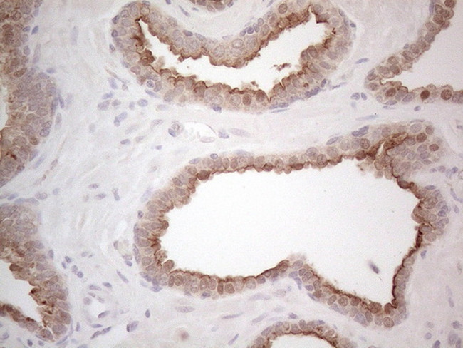 ABCC5 Antibody in Immunohistochemistry (Paraffin) (IHC (P))