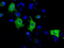 ACAT2 Antibody in Immunocytochemistry (ICC/IF)