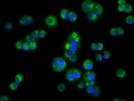 ACAT2 Antibody in Immunocytochemistry (ICC/IF)