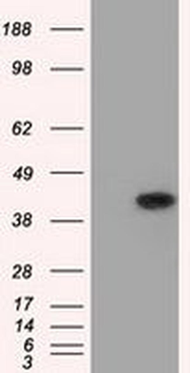 ACAT2 Antibody in Western Blot (WB)