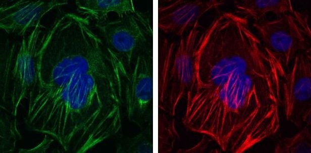 Alpha-Smooth Muscle Actin Antibody in Immunocytochemistry (ICC/IF)