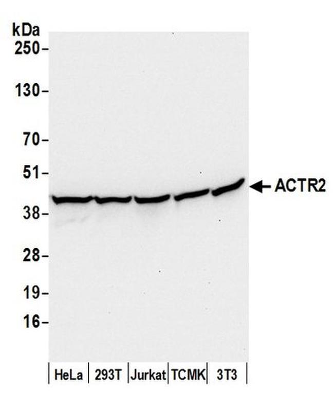 ACTR2/ARP2 Antibody in Western Blot (WB)