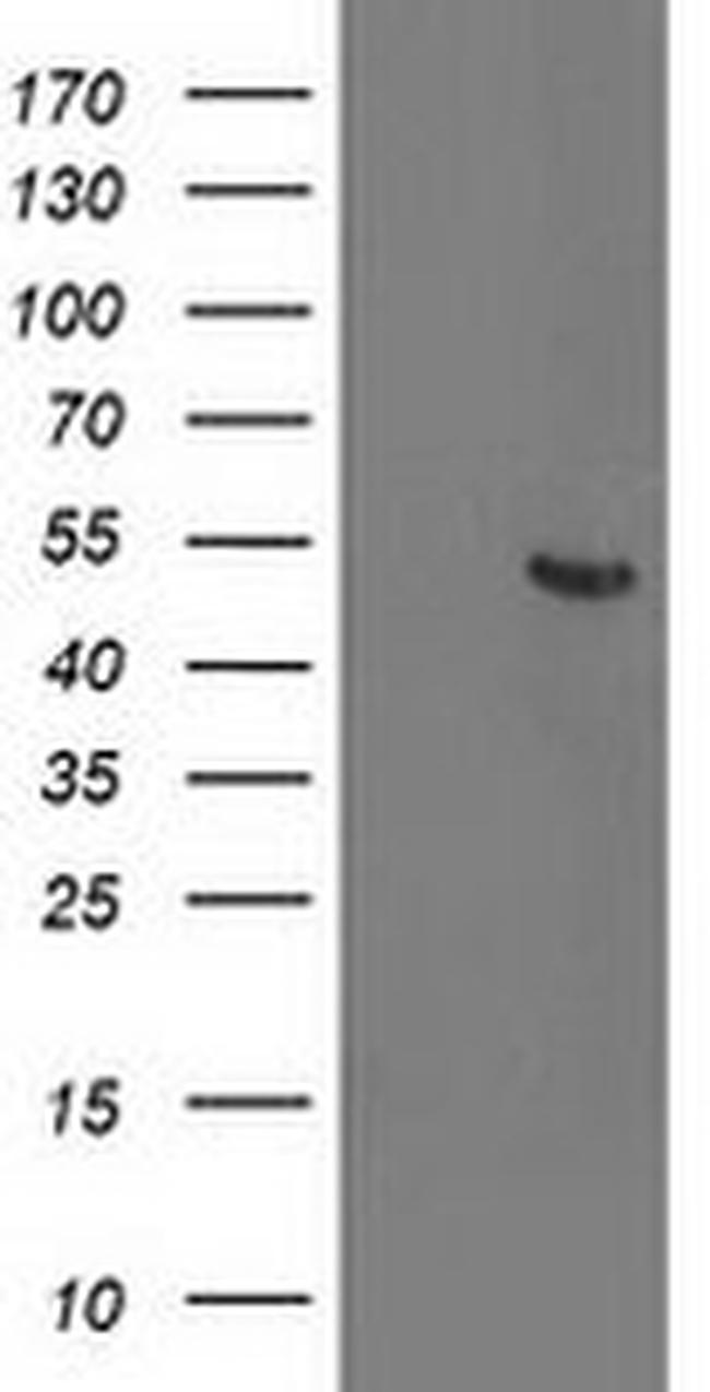 ACY1 Antibody in Western Blot (WB)