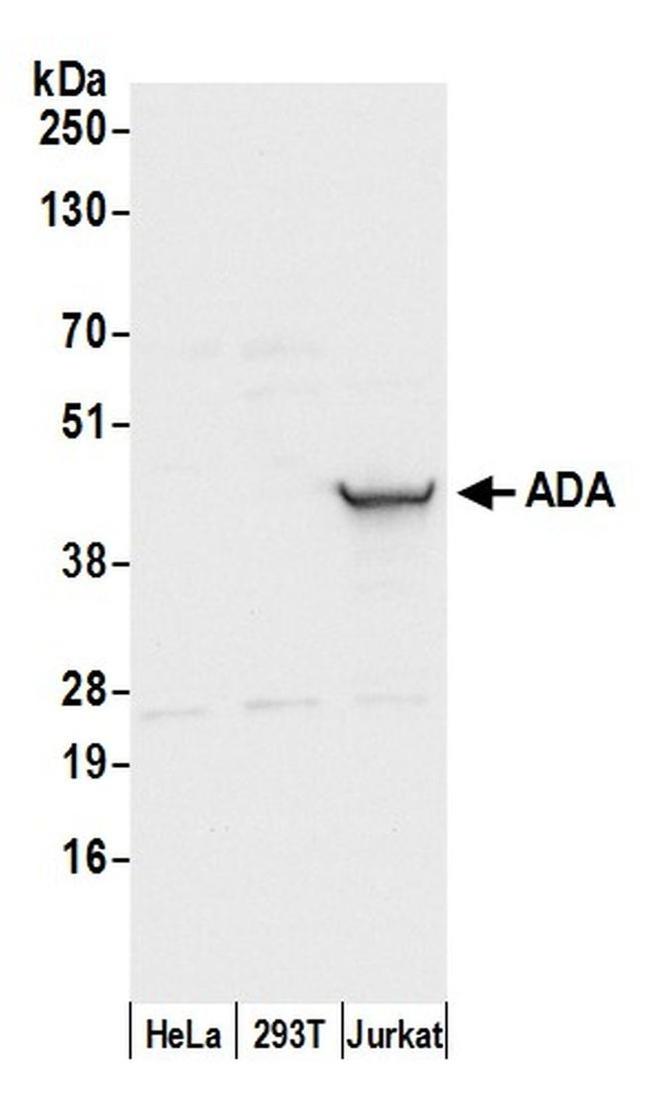 ADA/Adenosine Deaminase Antibody in Western Blot (WB)