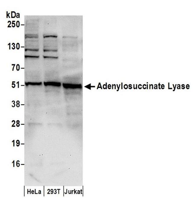 Adenylosuccinate Lyase/ADSL Antibody in Western Blot (WB)