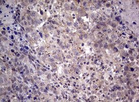 AFAP1 Antibody in Immunohistochemistry (Paraffin) (IHC (P))