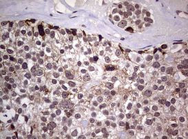 AFAP1 Antibody in Immunohistochemistry (Paraffin) (IHC (P))