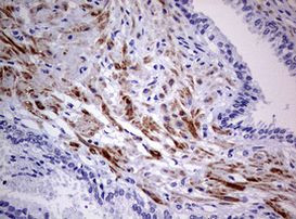 AFAP1 Antibody in Immunohistochemistry (Paraffin) (IHC (P))