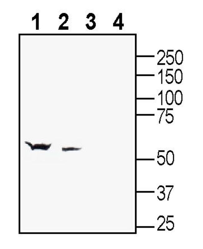 GABA(A) Beta 2 Receptor Polyclonal Antibody (AGA-012-200UL)