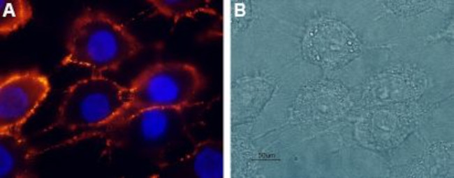 NMDAR2A (GluN2A) (extracellular) Antibody in Immunocytochemistry (ICC/IF)