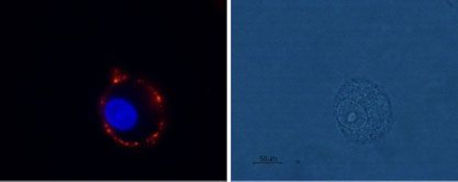 mGluR1 (extracellular) Antibody in Immunocytochemistry (ICC/IF)