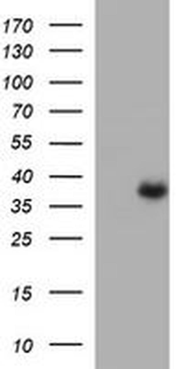 ARG2 Antibody in Western Blot (WB)