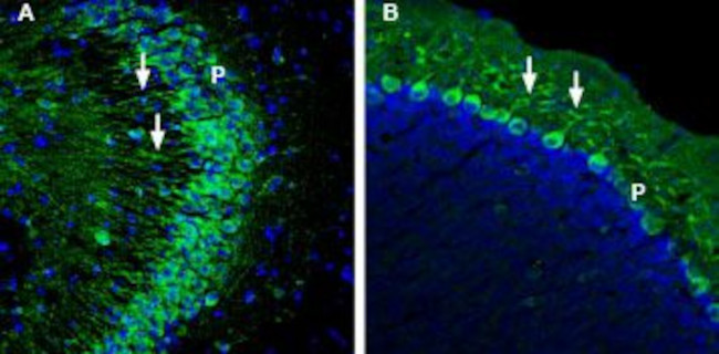 GLUT5 (SLC2A5) Antibody in Immunohistochemistry (Frozen) (IHC (F))