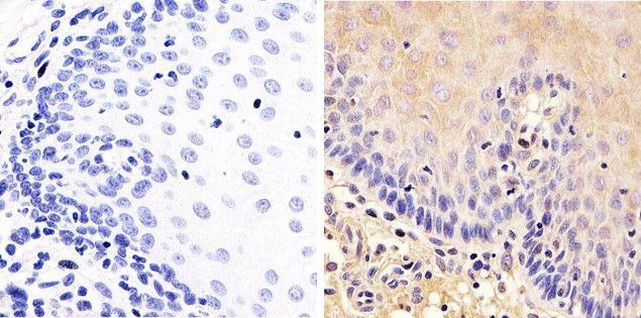 SRC Antibody in Immunohistochemistry (Paraffin) (IHC (P))