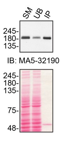 TSC2 Antibody in Immunoprecipitation (IP)