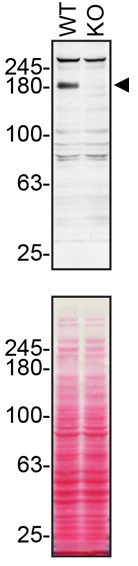 TSC2 Antibody