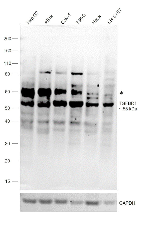 TGFBR1 Antibody in Western Blot (WB)