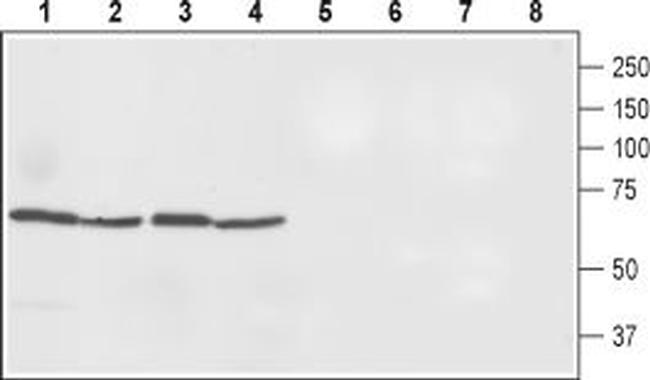 Ferroportin (SLC40A1) Antibody in Western Blot (WB)