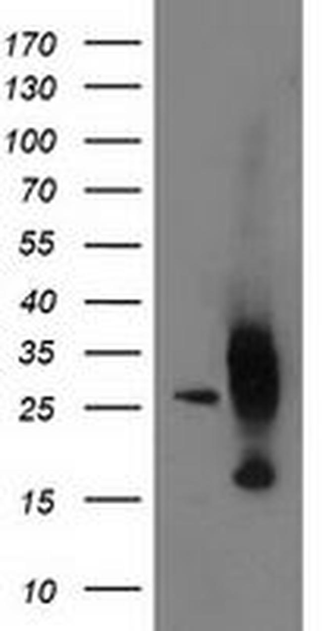 AK4 Antibody in Western Blot (WB)