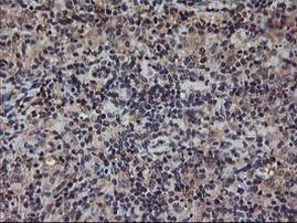 AKT1 Antibody in Immunohistochemistry (Paraffin) (IHC (P))