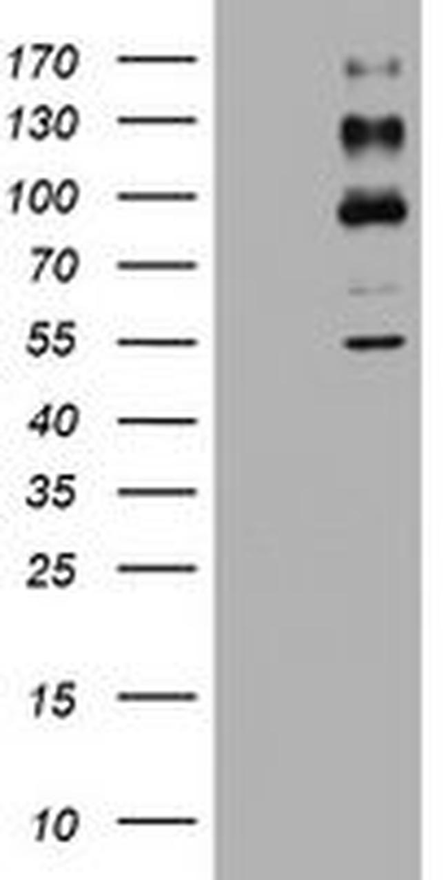 ALK Antibody in Western Blot (WB)