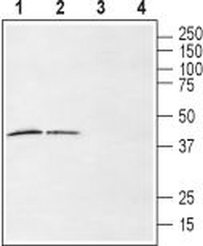 LPAR6 (P2RY5) (extracellular) Antibody in Western Blot (WB)