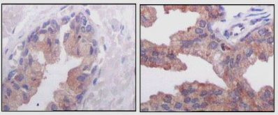 AMACR Antibody in Immunohistochemistry (Paraffin) (IHC (P))