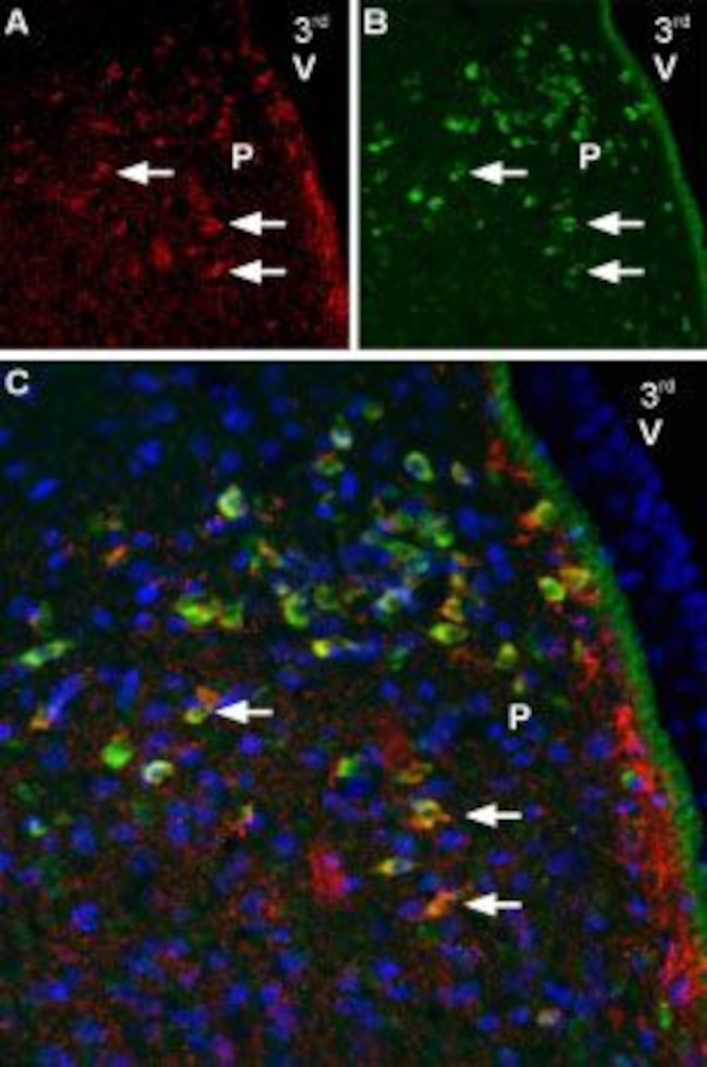 Melatonin Receptor 1B (MTNR1B) Antibody in Immunohistochemistry (Frozen) (IHC (F))