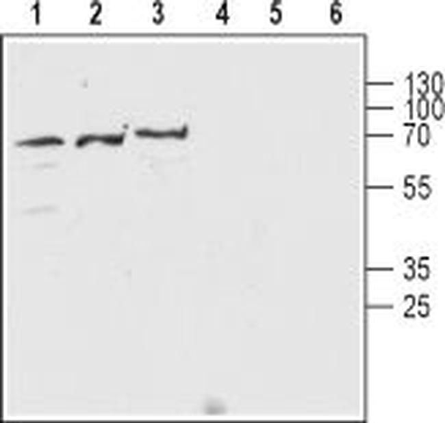 Nicotinic Acetylcholine Receptor beta 2 (CHRNB2) (extracellular) Antibody in Western Blot (WB)