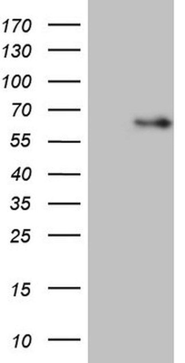 ANGPT2 Antibody in Western Blot (WB)