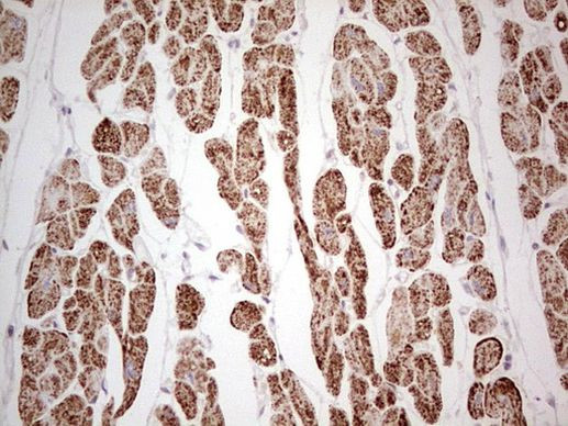 ANO1 Antibody in Immunohistochemistry (Paraffin) (IHC (P))