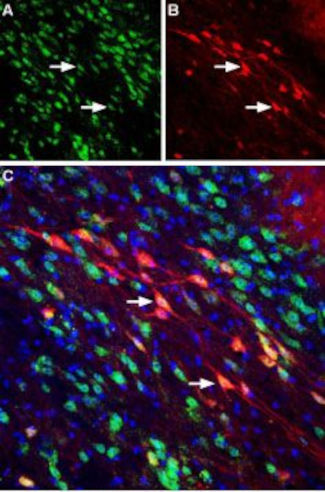 Neuropilin-2 (NRP2) (extracellular) Antibody in Immunohistochemistry (Frozen) (IHC (F))