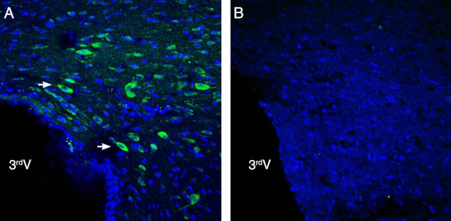 NGL-2/LRRC4 (extracellular) Antibody in Immunohistochemistry (Frozen) (IHC (F))